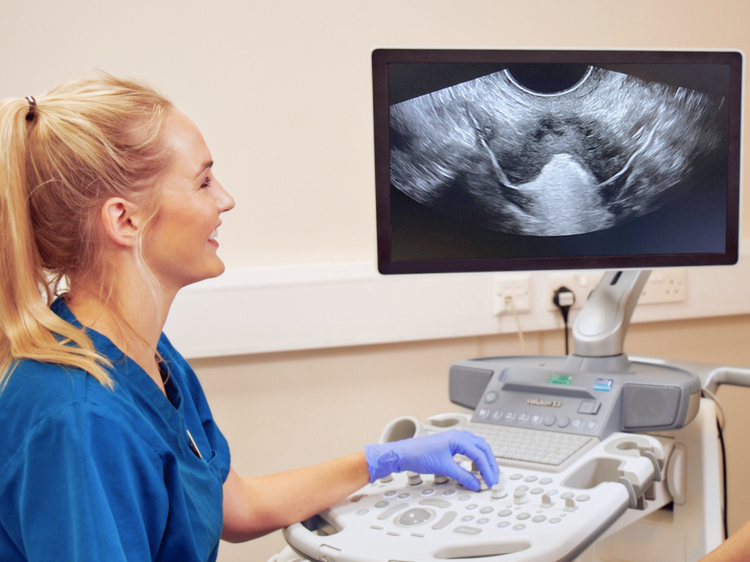 Becky, Sonographer at Manchester Fertility, reviewing a HyCoSy scan