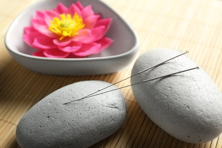 Acupuncture Therapy