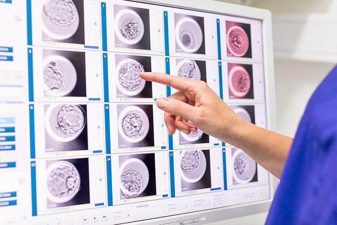 Manchester Fertility Technology